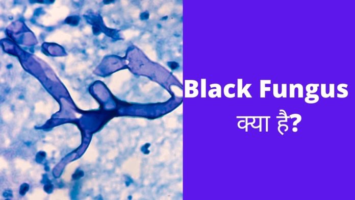 Black Fungus Kya Hai in Hindi